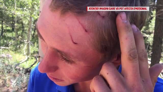 Un tânăr a scăpat cu viață după ce a fost atacat de un rechin, un urs și un șarpe cu clopoței