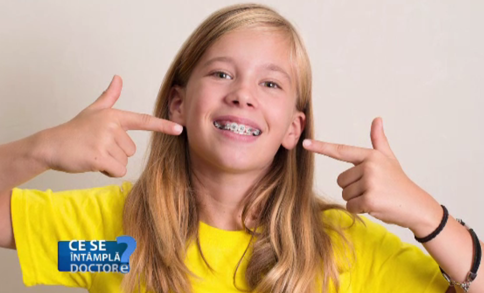 Dinții strâmbi se deteriorează primii. Metoda prin care putem verifica mușcătura