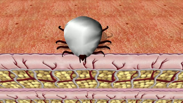 Zeci de persoane au ajuns la spital, după ce au fost mușcate de căpușe. Sfatul medicilor