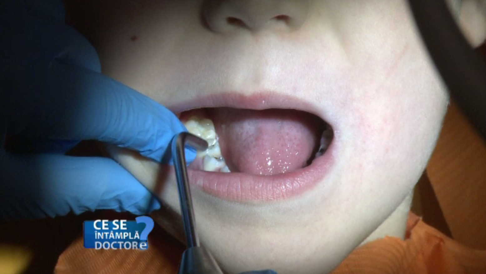 Este sau nu nevoie de anestezie pentru copil, la dentist