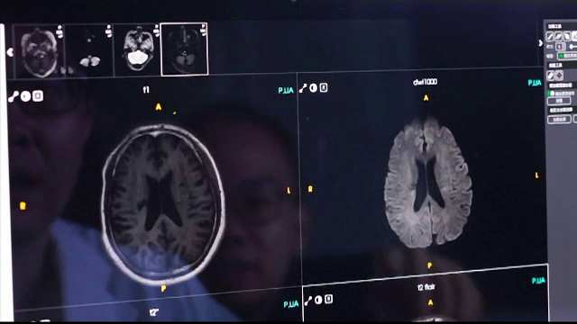 O echipă formată din 30 de medici, învinsă de inteligența artificială. Sarcina primită