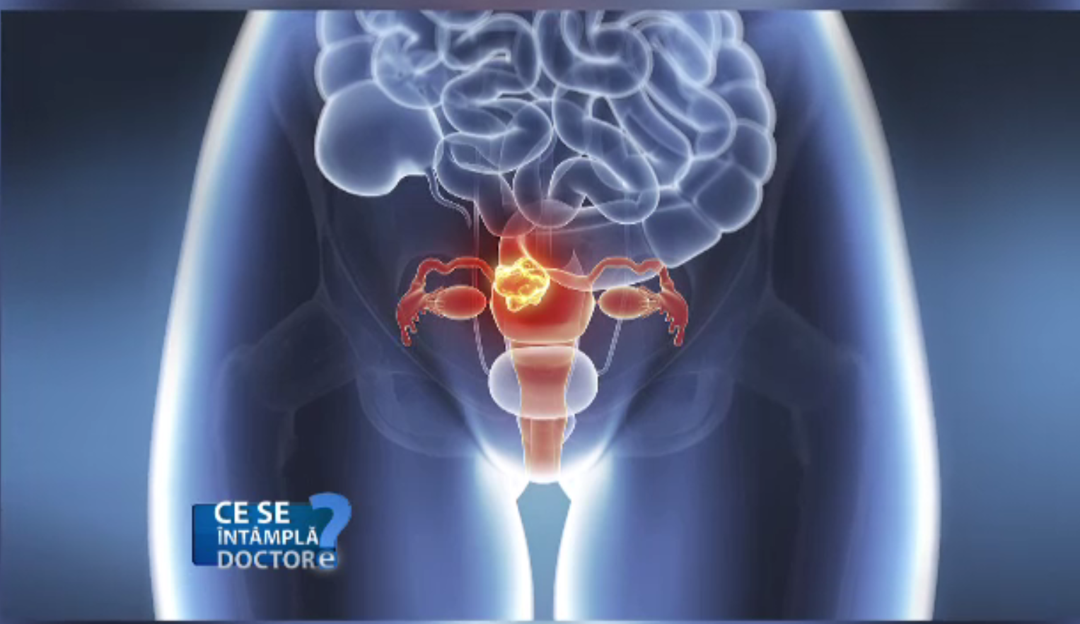 Cea mai frecventă boală cu transmitere sexuală în rândul tinerilor. Cum poate fi tratată