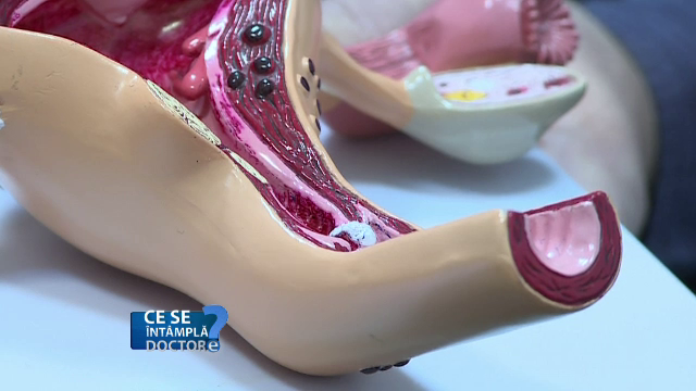 Durerile abdominale și infecțiile urinare dese pot duce la incapacitatea de a obține o sarcină