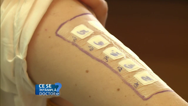 Riscurile la care se expun alergicii la nichel. Se găsește chiar și în bijuterii