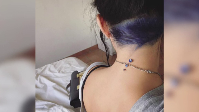 Cât de periculoase sunt bijuteriile montate sub piele. Avertismentul medicilor