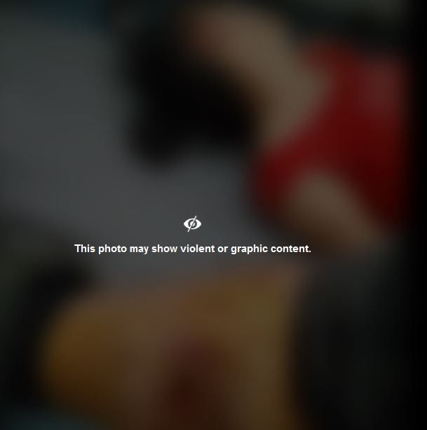 Imaginea publicată de un protestatar: ”Ăla e piciorul meu, iar fata de lângă mine a fost bătută până a leșinat”