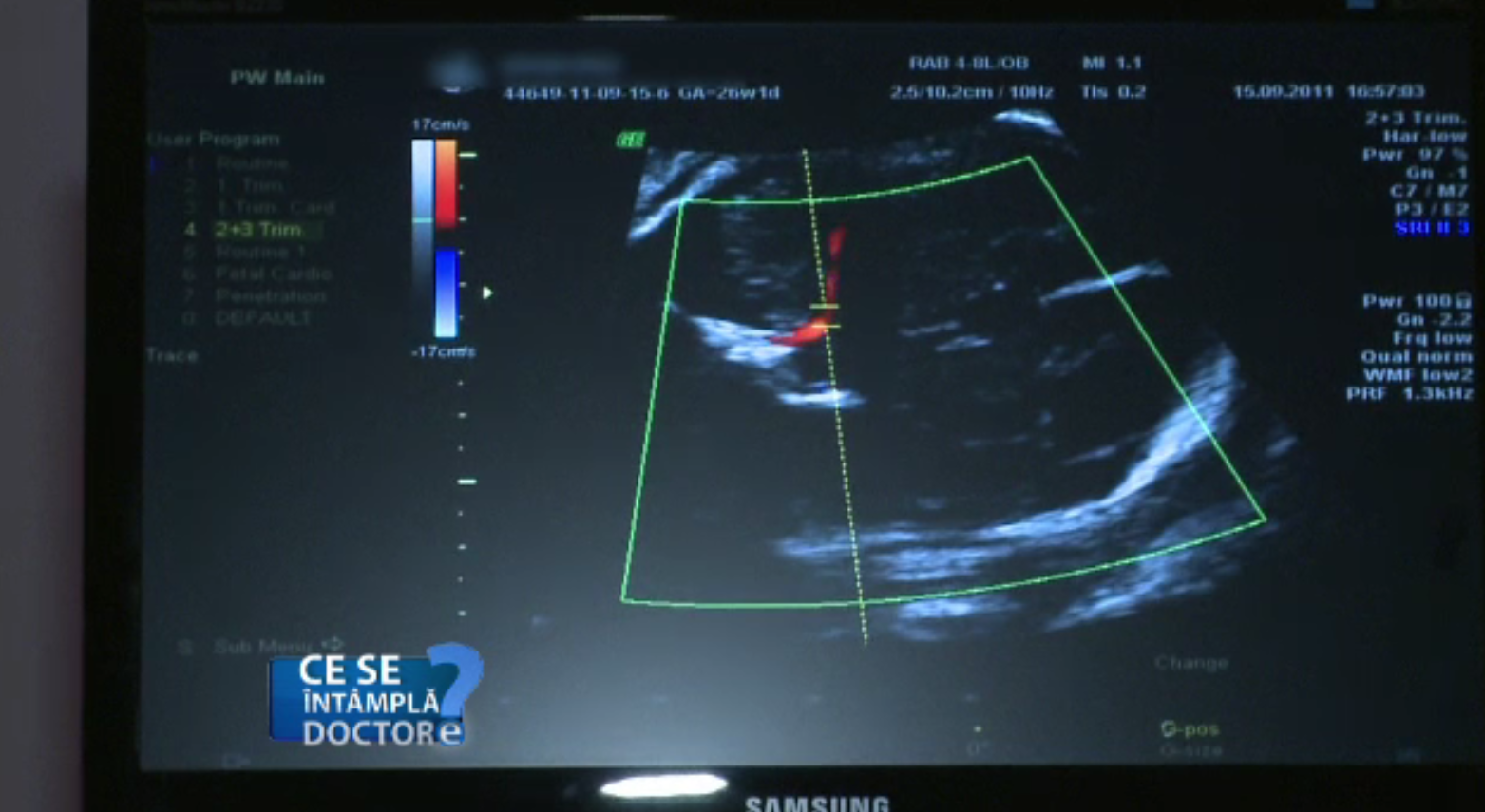 Motivul pentru care gravidele trebuie să fie extrem de atente la fructele și legumele consumate pe perioada sarcinei