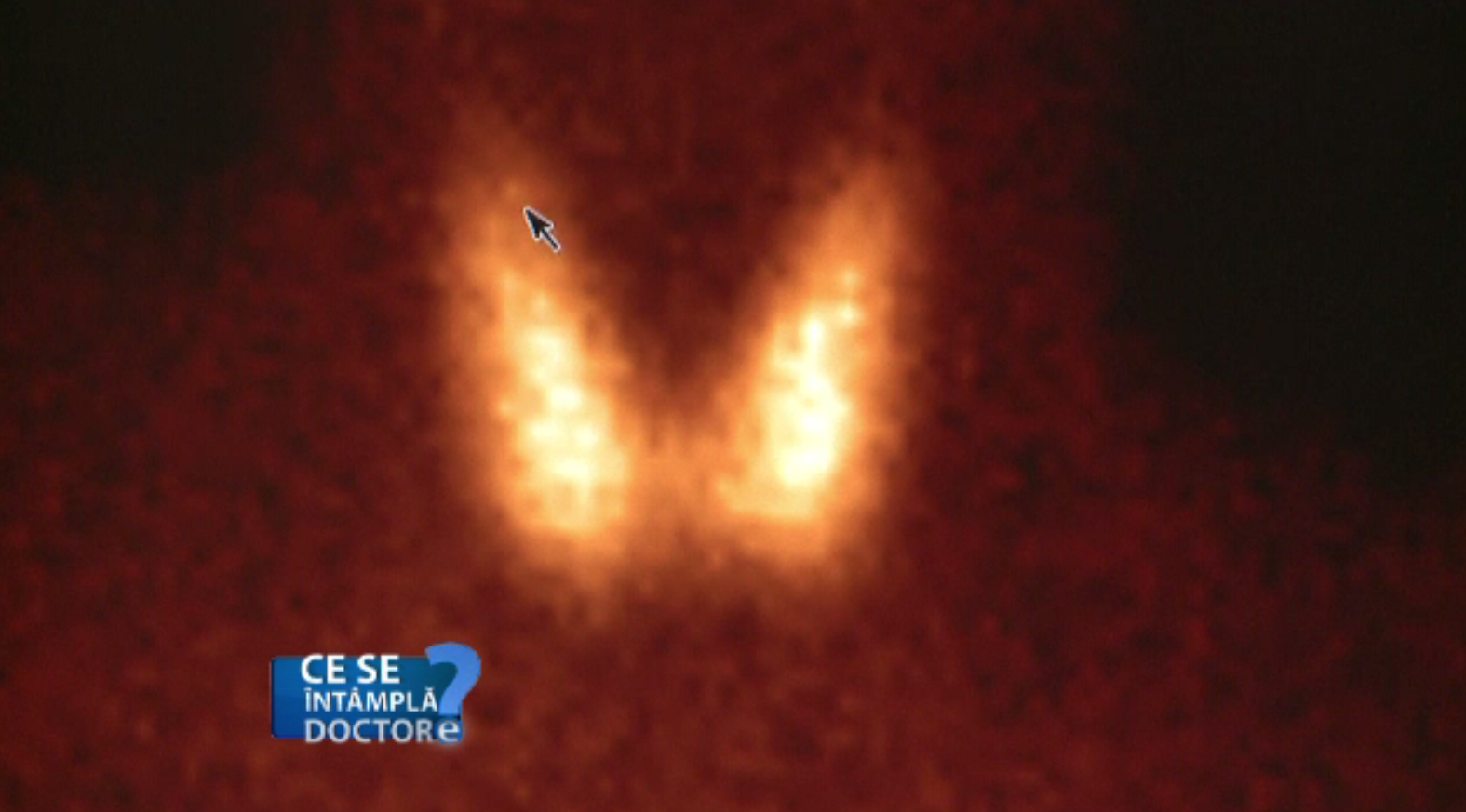 Principalele cauze ale infertilității la femei. Ce spun medicii