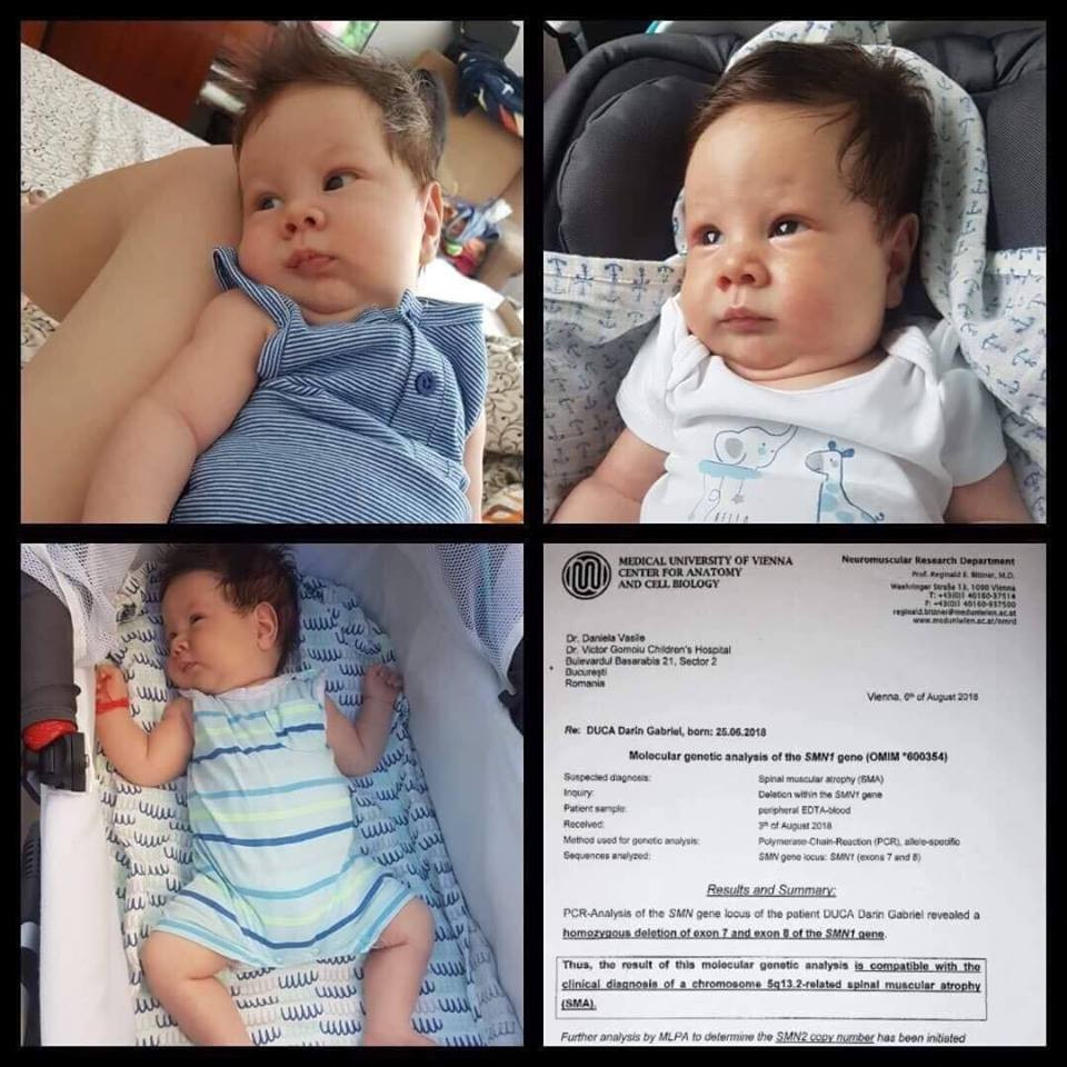 Apel pentru salvarea unui bebeluș de 2 luni. Darin a fost diagnosticat cu o boală rară