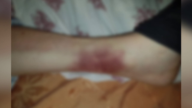 Pacient legat de mâini şi picioare de patul din salon, într-un spital din Iaşi. Acuzaţiile familiei