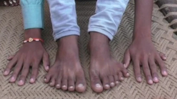 S-a născut cu 24 de degete, iar rudele vor să-l sacrifice. Ce le-a spus un vrăjitor