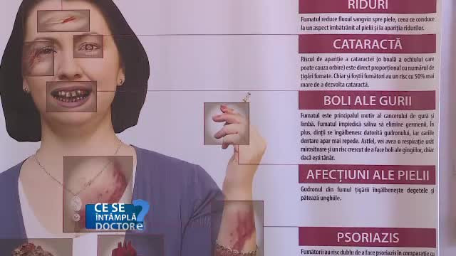 Cea mai eficientă metodă de a renunța la țigări