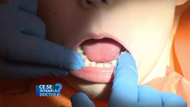 Cum să detectați primele carii ale copiilor. Măsurile care trebuie luate urgent