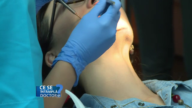 Ce sunt aparatele dentare linguale și cum se montează