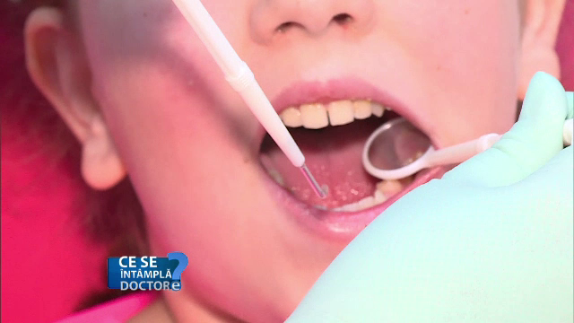 Petele de pe suprafața dinților, cauzate de medicamente. Ce puteți face