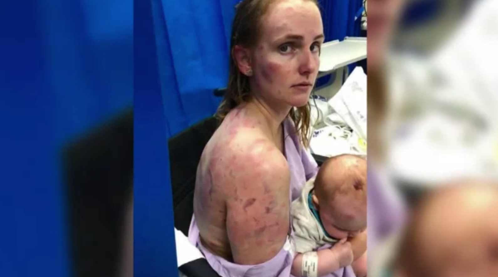 O tânără mamă și-a folosit trupul ca scut pentru a-și proteja fetița de 4 luni