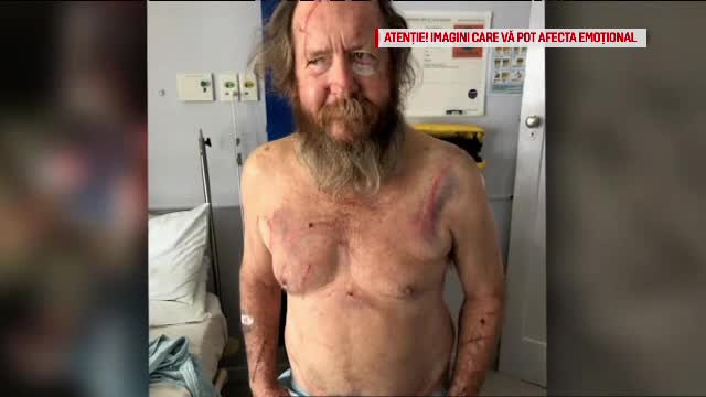 Un cangur a atacat cu brutalitate o familie din Australia. Rănile suferite de cei doi soți