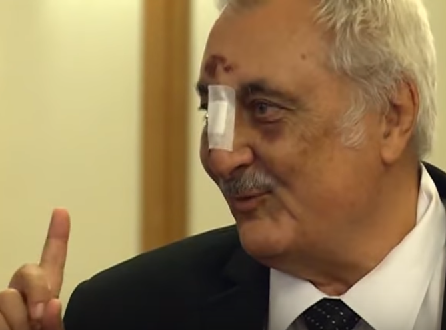 Deputatul PSD Bacalbașa a venit la Parlament cu nasul spart și ochii vineți: Am agățat o bordură