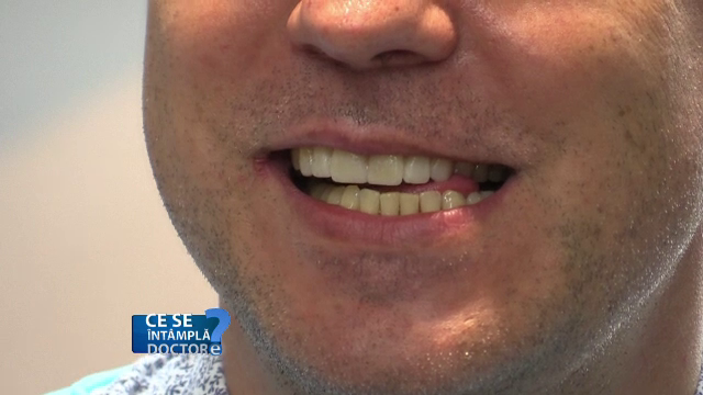 Intervențiile stomatologice, realizate cu ajutorul tehnologiei digitale. Care e avantajul