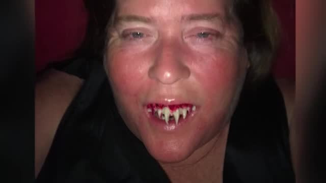 Și-a lipit dinți de zombie de Halloween, dar după petrecere a avut un șoc: ”Nu mai fac niciodată”