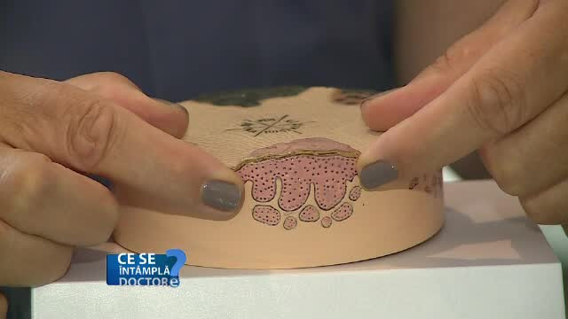 Modificările la nivelul scalpului trebuie să vă trimită la medic. Bolile ascunse ce pot fi identificate