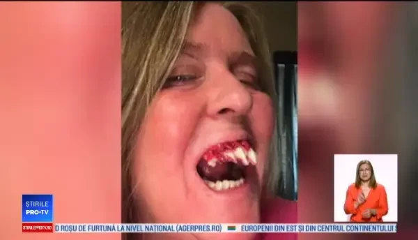 Și-a lipit dinți de zombie de Halloween, dar după petrecere a avut un șoc: ”Nu mai fac niciodată”