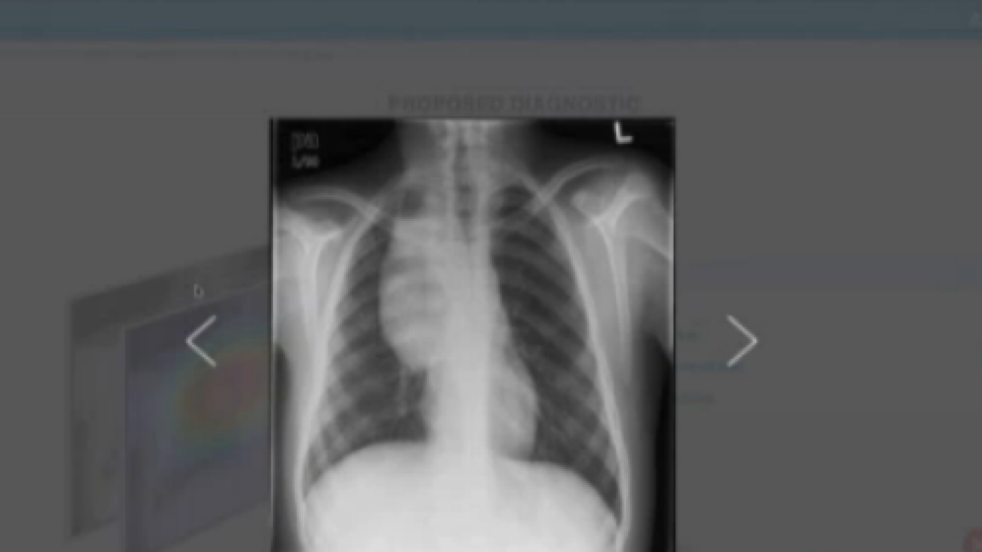 iLikeIT. Platforma care poate interpreta radiografiile