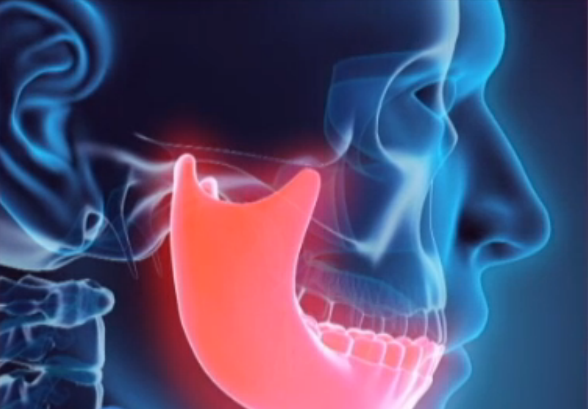 Ce se întâmplă dacă mușcăm cu dinții aliniați incorect