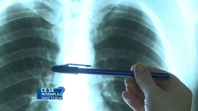 Investigația care detectează cele mai grave boli respiratorii