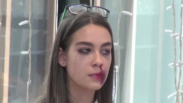 Imagini tulburătoare cu femei bătute: ”S-a enervat că nu era gata mâncarea”