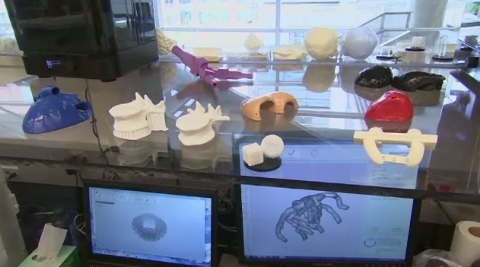 Anchetă de proporții. Mii de pacienți au primit implanturi medicale nesigure și insuficient testate