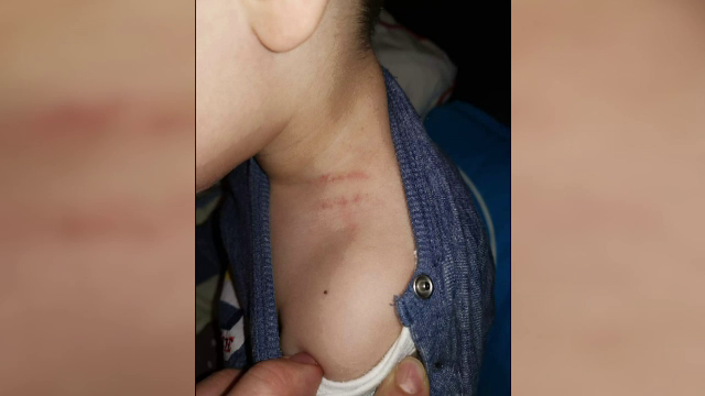 Cazul copilului de 3 ani care ar fi fost agresat de educatoare, anchetat de criminalişti