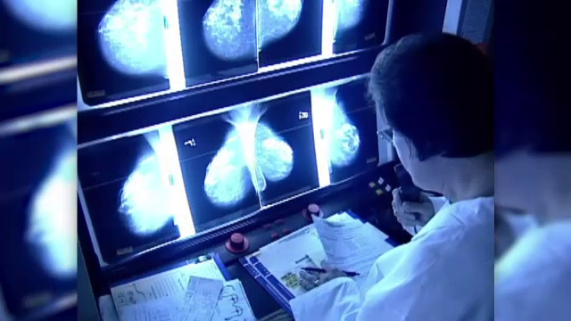 Cercetătorii australieni eu dezvoltat un test care detectează cancerul în doar 10 minute