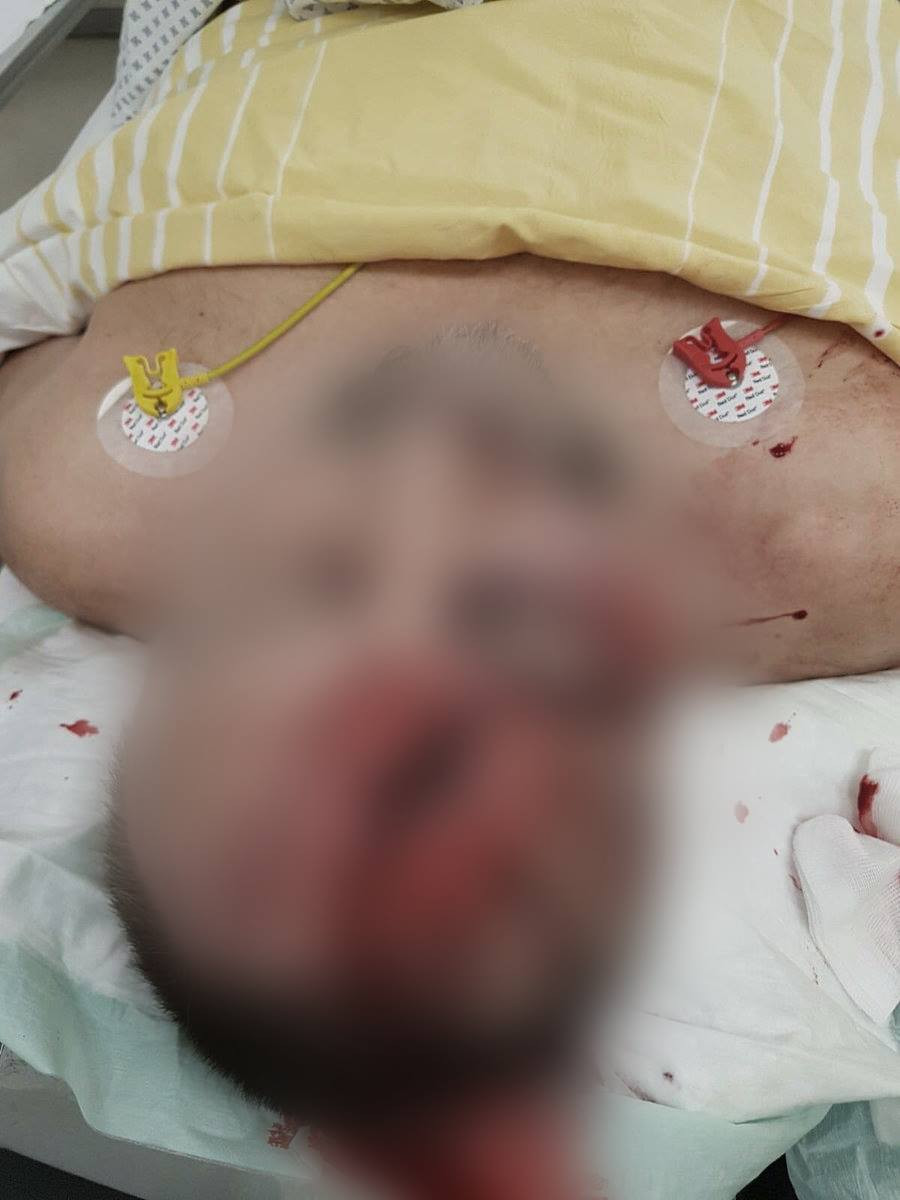 Politician german atacat brutal de mascați: "L-au lovit cu o bâtă de lemn”