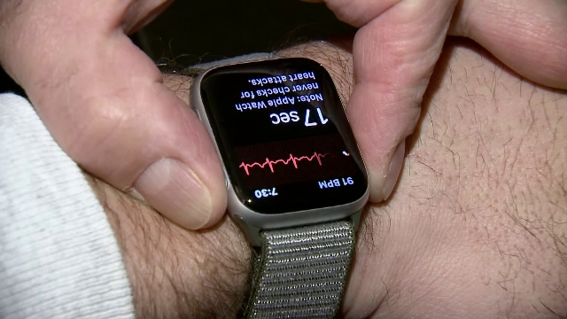 Un ceas inteligent i-a salvat viața unui bărbat. Problema de care nici medicii nu știau