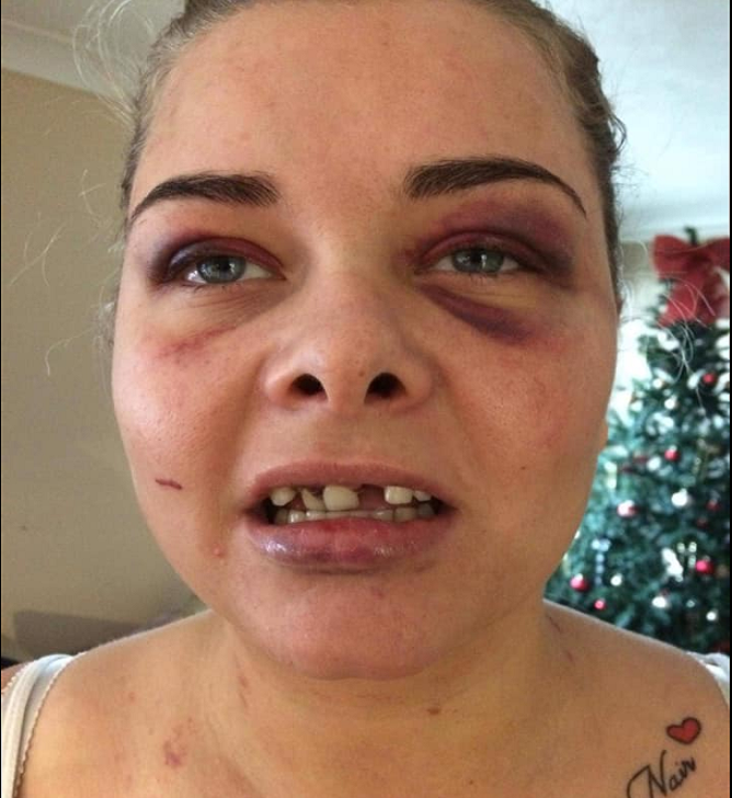 Și-a lăsat iubita fără 3 dinți, după ce a postat pe Facebook o poză doar cu ea