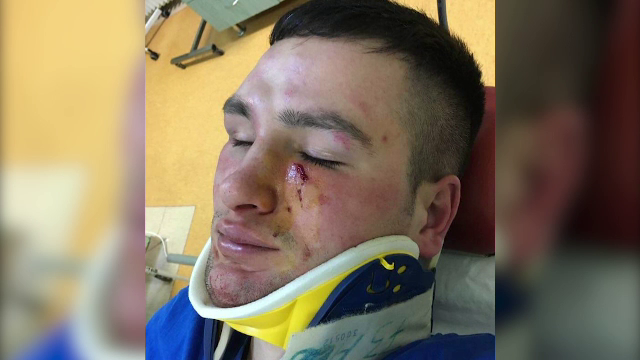 Polițist desfigurat de un om de afaceri după ce l-a amendat. Agresorul a fost lăsat liber