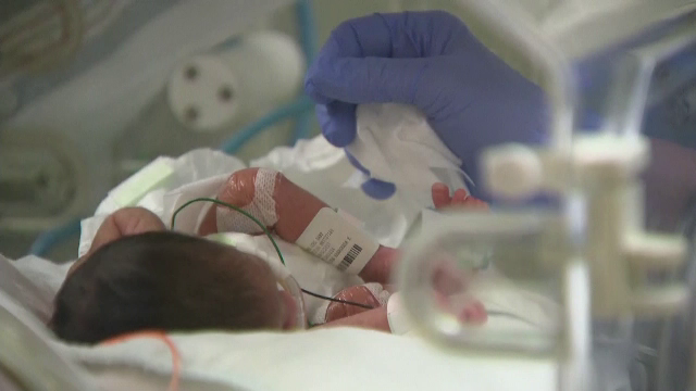 Legătura dintre căldura excesivă şi creşterea numărului de bebeluşi cu defecte cardiace congenitale