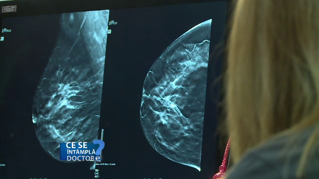 Liposculptura, alternativa la implanturile mamare. În ce constă procedura