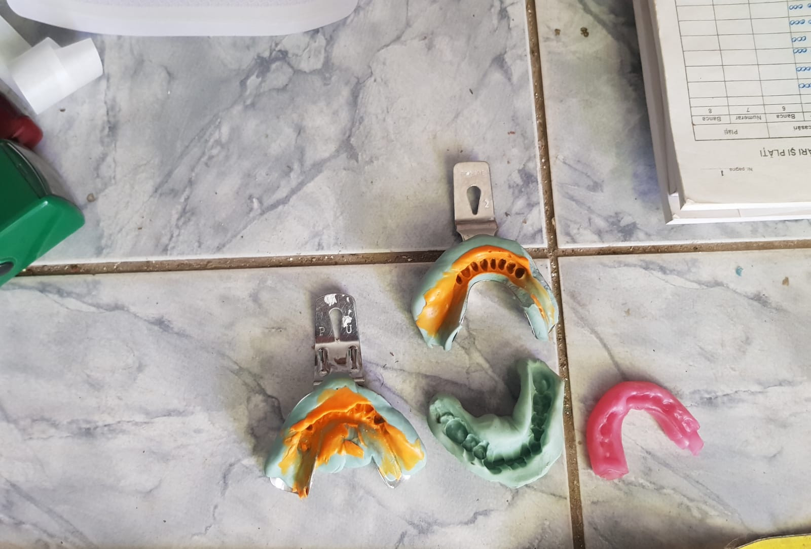 Fost zidar din Ilfov, anchetat pentru că ar fi făcut pe dentistul. Imagini din "cabinet"