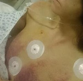 Mamă şi fiică, răpite şi torturate de vecina invalidă. Chinurile la care au fost supuse