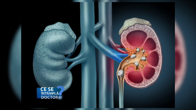 Cele două boli extrem de frecvente în rândul românilor. Sunt cauzate de poluare