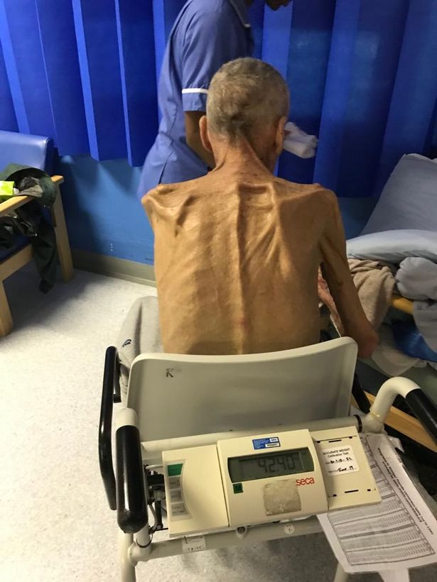 Ce s-a întâmplat cu bărbatul care cântăreşte doar 38 de kg şi statul îl obliga să muncească