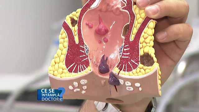 Simptomele care indică 8 afecțiuni diferite. Situația în care trebuie să mergeți la chirurg