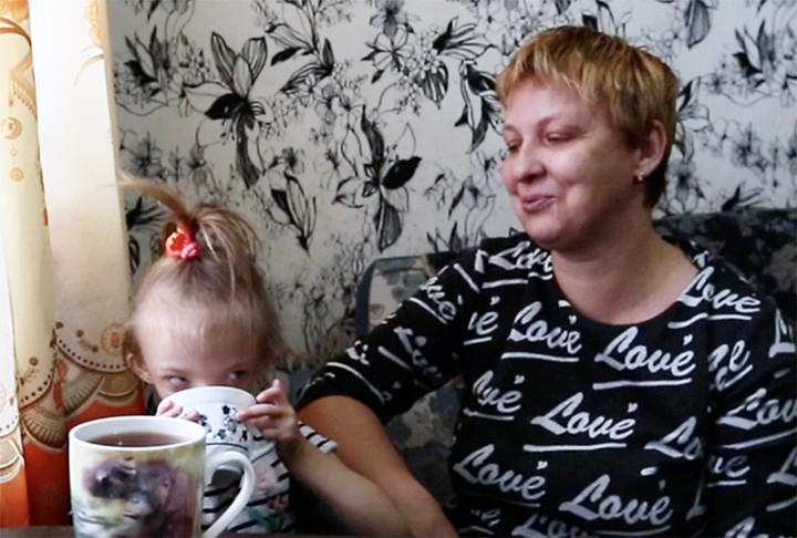 O fetiţă s-a născut cu jumătate de faţă. Mama a leşinat când a văzut-o prima dată