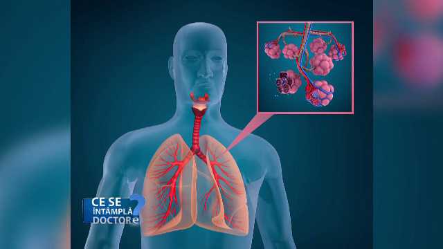 OMS a pus astmul pe lista bolilor care fac pacienții mai vulnerabili la Covid-19