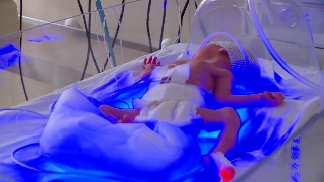 Lipsa de aparatură din spitale ucide mii de bebeluşi. Unde sunt incubatoarele promise de minister