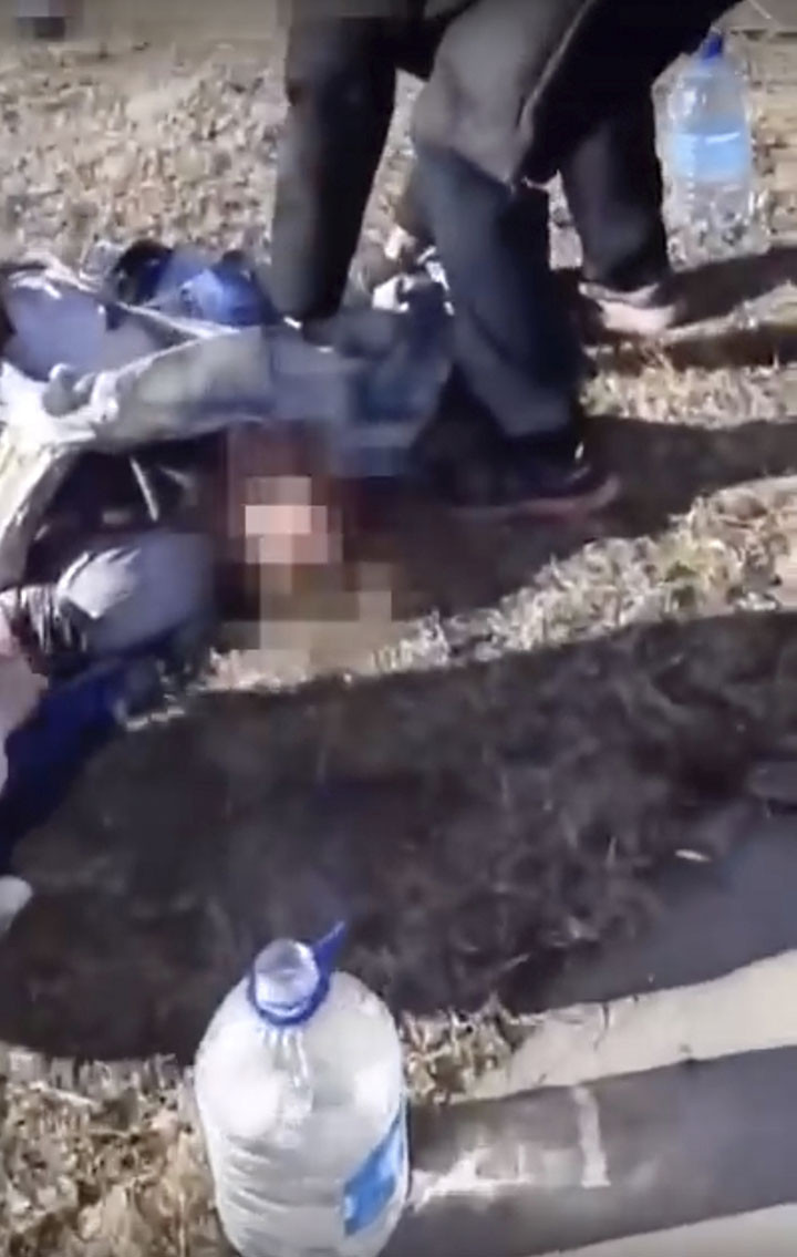 O tânără a rămas fără ambele mâini după ce a fost atacată de urşi în camping