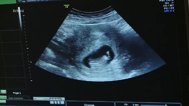 Concediu suplimentar pentru femeile care apelează la fertilizarea in vitro