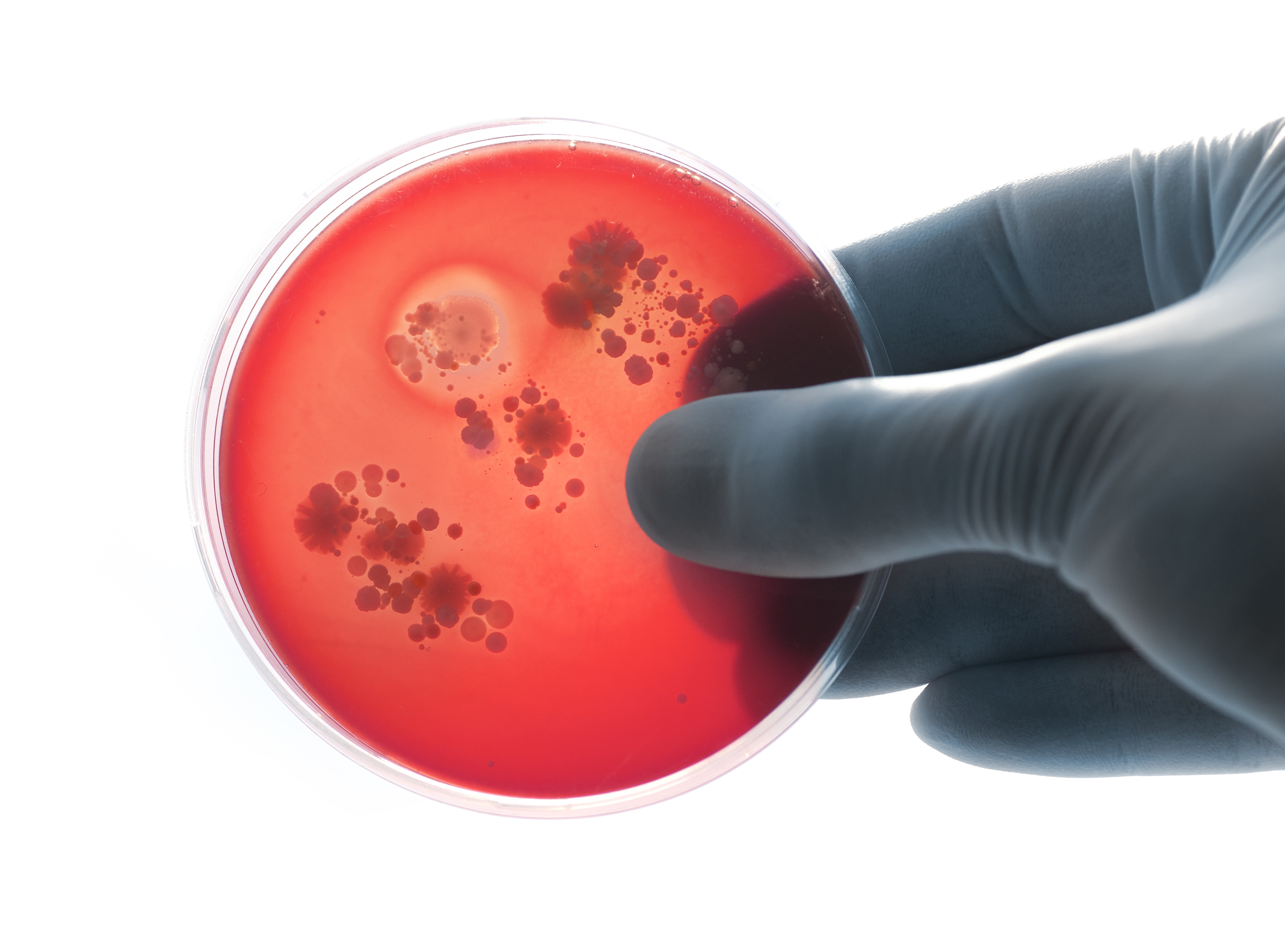 O tânără de 16 ani, venită din Italia, suspectă de meningită meningococică